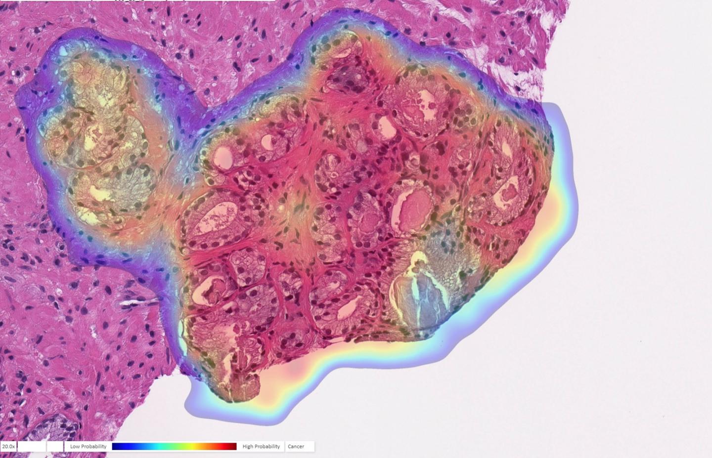 AI Prostate Cancer Detection: 9 Crucial Steps for Rigorous Evaluation